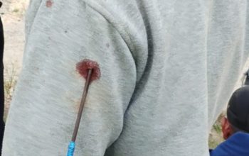 Insiden Berdarah Kembali Terjadi Di PT ANA, Pemerintah Didesak Gercep Selesaikan Konflik Agraria