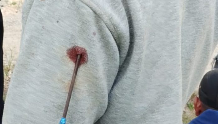 Insiden Berdarah Kembali Terjadi Di PT ANA, Pemerintah Didesak Gercep Selesaikan Konflik Agraria